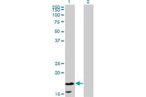 Western Blotting (WB) image for anti-Calmodulin-Like 5 (CALML5) (AA 1-147) antibody (ABIN599566)