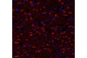 Immunofluorescence of paraffin embedded rat hippocampus using ATP5A1 (ABIN7073141) at dilution of 1: 300 (200x lens)