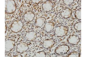 anti-Leucine Zipper Transcription Factor-Like 1 (LZTFL1) (AA 200-299) antibody