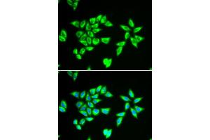 Immunofluorescence analysis of MCF-7 cell using PTRH2 antibody. (PTRH2 anticorps)
