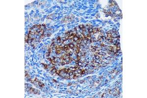 Immunohistochemistry of paraffin-embedded Rat ovary using MRPL30 Rabbit pAb (ABIN7268567) at dilution of 1:100 (40x lens). (MRPL30 anticorps  (AA 1-161))