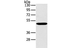 Western Blot analysis of Huvec cell using PPP2R3C Polyclonal Antibody at dilution of 1:400 (PPP2R3C anticorps)