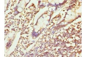 Immunohistochemistry of paraffin-embedded human small intestine tissue using ABIN7147524 at dilution of 1:100