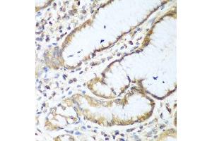 Immunohistochemistry of paraffin-embedded human stomach using NUDT15 antibody.