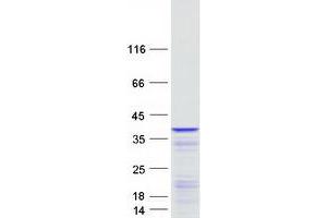 Validation with Western Blot