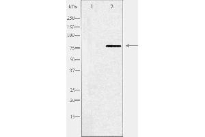 Western blot analysis of extracts from COLO cells, using ABCB10 antibody. (ABCB10 anticorps  (Internal Region))