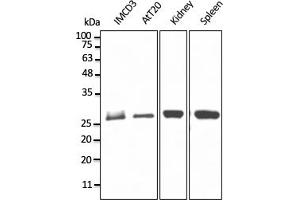 Western Blotting (WB) image for anti-RAB11B, Member RAS Oncogene Family (RAB11B) (C-Term) antibody (ABIN1440027) (RAB11B anticorps  (C-Term))