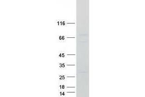 Validation with Western Blot