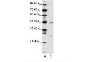 Image no. 1 for anti-MAX Dimerization Protein 4 (MXD4) (N-Term) antibody (ABIN202068) (MXD4 anticorps  (N-Term))
