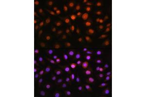 Immunofluorescence analysis of L929 cells using DDIT3/CHOP antibody (ABIN3020709, ABIN3020710, ABIN3020711, ABIN1512759 and ABIN6213685) at dilution of 1:100. (DDIT3 anticorps  (C-Term))