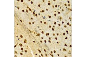 Immunohistochemistry of paraffin-embedded rat brain using HNRNPA2B1 Antibody. (HNRNPA2B1 anticorps  (AA 1-180))