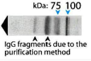 Western blot analysis on human brain lysate under reducing conditions using AP1B1 polyclonal antibody  at a dilution of 1 : 100. (AP1B1 anticorps  (AA 11-29))