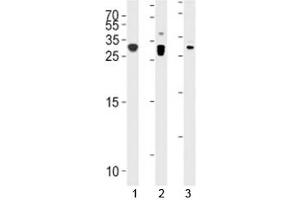 p27Kip1 antibody western blot analysis in 1) A431, 2) HeLa, and 3) mouse C2C12 lysate