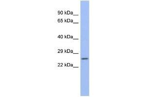 WB Suggested Anti-ZNRF1 Antibody Titration:  0. (ZNRF1 anticorps  (N-Term))