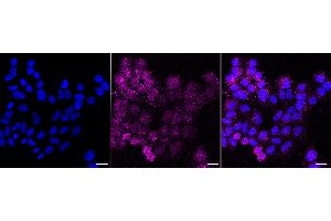 Immunocytochemical staining of HepG2 cells with CD102 antibody (ABIN7799078), 1:1,000).