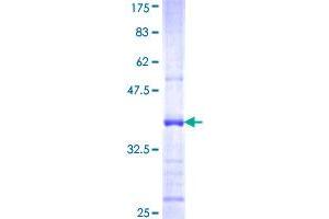 Image no. 1 for Interleukin 22 Receptor, alpha 1 (IL22RA1) (AA 1-110) protein (GST tag) (ABIN1307784)