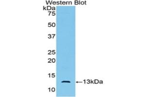 Western blot analysis of the recombinant protein. (AMH anticorps)