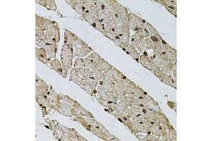 Immunohistochemistry of paraffin-embedded mouse heart using PHF1 antibody (ABIN5974685) at dilution of 1/100 (40x lens). (PHF1 anticorps)