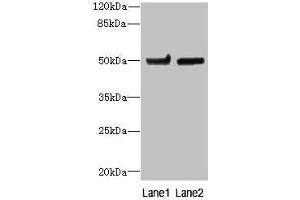 Western blot All lanes: TUBB6 antibody at 4 μg/mL Lane 1: Hela whole cell lysate Lane 2: MDA-MB-231 whole cell lysate Secondary Goat polyclonal to rabbit IgG at 1/10000 dilution Predicted band size: 50 kDa Observed band size: 50 kDa (TUBb6 anticorps  (AA 1-446))