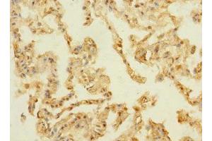Immunohistochemistry of paraffin-embedded human lung tissue using ABIN7159336 at dilution of 1:100 (PAQR5 anticorps  (AA 1-51))