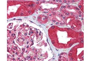 Image no. 1 for anti-ATP-Binding Cassette, Sub-Family B (MDR/TAP), Member 1 (ABCB1) (AA 262-277) antibody (ABIN302909)