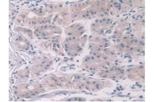 IHC-P analysis of Human Stomach Tissue, with DAB staining. (NOTCH2NL anticorps  (AA 1-236))