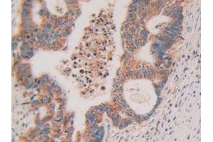 Figure. (Cytochrome C anticorps  (AA 5-100))