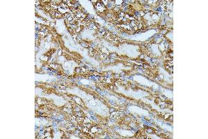 Immunohistochemistry of paraffin-embedded mouse kidney using IVD antibody (ABIN7268031) at dilution of 1:100 (40x lens).