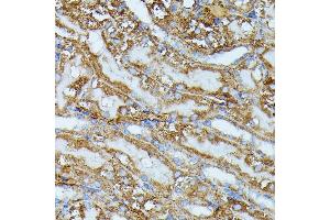 Immunohistochemistry of paraffin-embedded mouse kidney using IVD antibody (ABIN7268031) at dilution of 1:100 (40x lens). (IVD anticorps  (AA 33-200))