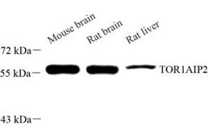 Western blot analysis of TOR1AIP2 (ABIN7075941) at dilution of 1: 500 (TOR1AIP2 anticorps)