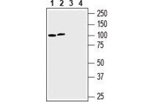 Western blot analysis of human chronic myelogenous leukemia K562 (lanes 1 and 3) and human prostate carcinoma LN-CaP (lanes 2 and 4) cell lines lysates: - 1, 2. (SLC43A1 anticorps  (4th Extracellular Loop))