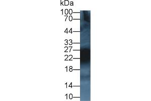 Detection of CD99 in Rat Thymus lysate using Polyclonal Antibody to Cluster Of Differentiation 99 (CD99) (CD99 anticorps  (AA 26-160))