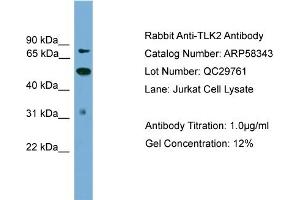 WB Suggested Anti-TLK2  Antibody Titration: 0. (TLK2 anticorps  (N-Term))