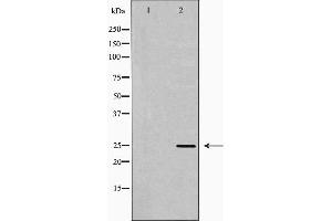 Western blot analysis of lovo cell lysate, using RAN Antibody. (RAN anticorps  (C-Term))