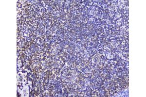 IHC analysis of AHR using anti-AHR antibody (ABIN6719265).