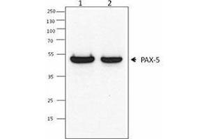 Western Blotting (WB) image for anti-Paired Box 5 (PAX5) antibody (ABIN2667347) (PAX5 anticorps)