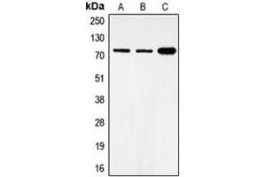 Western blot analysis of FOXO1 (pS319) expression in MCF7 (A), HeLa (B), NIH3T3 (C) whole cell lysates.