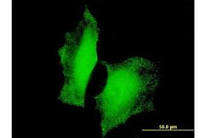 Immunofluorescence of monoclonal antibody to FOXO3 on HeLa cell.