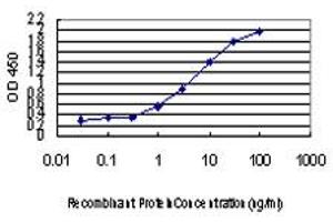 anti-Lysine (K)-Specific Demethylase 5A (KDM5A) (AA 191-290) antibody