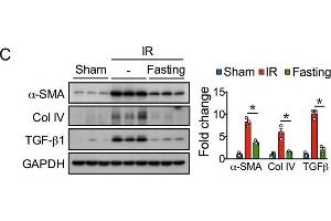 Effect of fasting on renal injury and development of fibrosis after two weeks of unilateral ischemia-reperfusion (IR) injury.