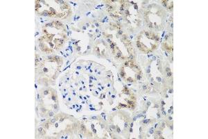 Immunohistochemistry of paraffin-embedded rat kidney using NEDD4L antibody (ABIN6132407, ABIN6144504, ABIN6144505 and ABIN6224109) at dilution of 1:200 (40x lens).