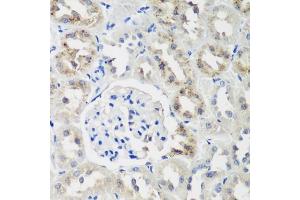 Immunohistochemistry of paraffin-embedded rat kidney using NEDD4L antibody (ABIN6132407, ABIN6144504, ABIN6144505 and ABIN6224109) at dilution of 1:200 (40x lens). (NEDD4-2 anticorps  (AA 836-955))