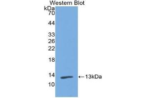 Western blot analysis of the recombinant protein. (PIGR anticorps  (AA 230-331))