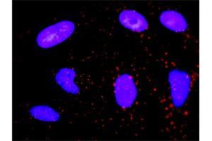 Proximity Ligation Analysis of protein-protein interactions between CDK6 and CDKN1B.