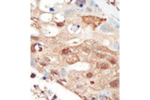Image no. 2 for anti-Phosphoinositide 3 Kinase, p85 beta (PI3K p85b) (C-Term) antibody (ABIN360460) (PIK3R2 anticorps  (C-Term))