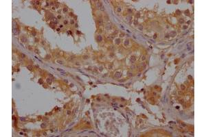 IHC image of ABIN7140004 diluted at 1:200 and staining in paraffin-embedded human testis tissue performed on a Leica BondTM system.