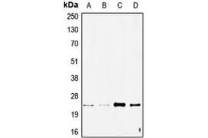 Western blot analysis of STMN2 expression in SHSY5Y (A), NIH3T3 (B), A549 (C), rat brain (D) whole cell lysates.