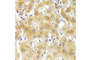 Immunohistochemistry of paraffin-embedded Human liver injury using EIF4G1 antibody at dilution of 1:100 (x400 lens). (EIF4G1 anticorps)