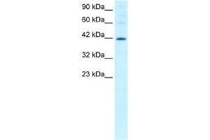 Human Jurkat; WB Suggested Anti-MIER1 Antibody Titration: 1. (MIER1 anticorps  (Middle Region))