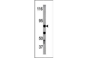 Image no. 1 for anti-Inhibitor of kappa Light Polypeptide Gene Enhancer in B-Cells, Kinase beta (IKBKB) (pTyr199) antibody (ABIN358141) (IKBKB anticorps  (pTyr199))